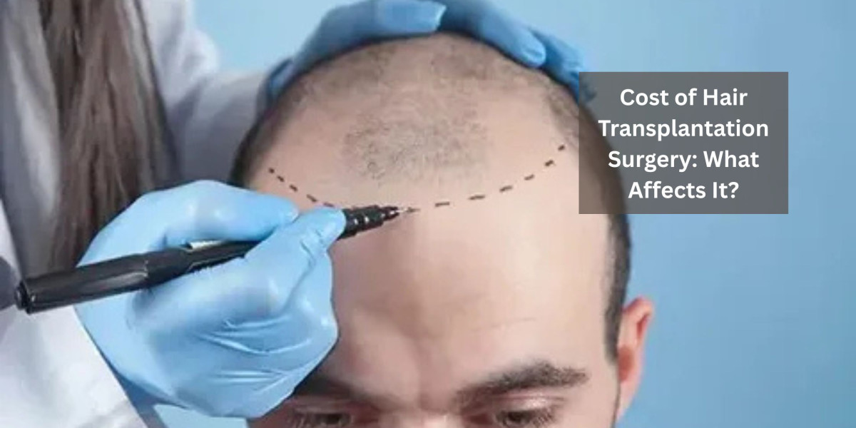 Cost of Hair Transplantation Surgery: What Affects It?